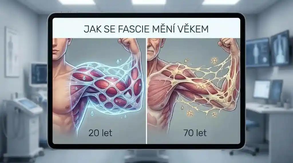 Jak se fascie mění věkem 2